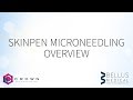 SkinPen Microneedling Overview