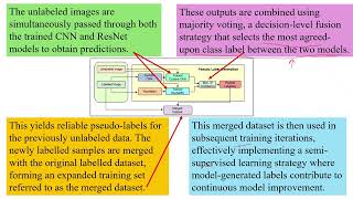 Semi Supervised Brain Tumor MRI Classification network
