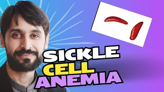 Sickle Cell Anemia | Causes | Symptoms | Diagnosis and Treatment | MLT Hub with kamran