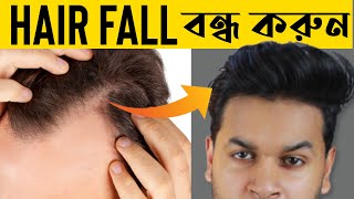 চুল পড়া বন্ধ করার উপায় । How to Stop Hair fall । ছেলেদের চুল পড়া বন্ধ করার উপায়
