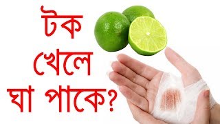 টক জাতীয় ফল খেলে কি ঘা পাকে ?