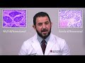 diagnosing neuroendocrine tumors