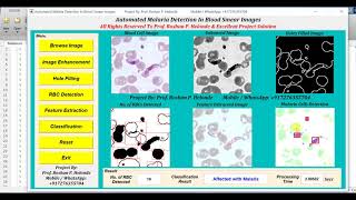 Malaria Detection Using Image Processing | IEEE Based Projects | With Source Code