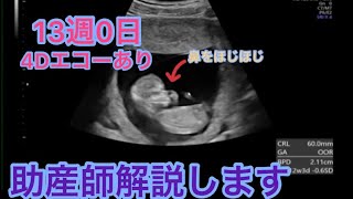 4Dエコーあり　妊娠13週　助産師解説します。