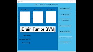 Brain Tumor Detection Using Matlab (SVM)