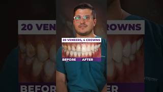 Dentist Amazed by Full Mouth Restoration! 😲 | UAB’s Joe Molisani #shorts