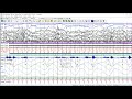 natus eeg psg tutorial neuroworks sleepworks 9 traces visualization