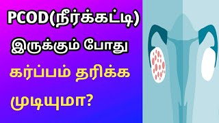 PCOD (நீர்க்கட்டி) இருக்கும் போது கர்ப்பம் தரிக்க முடியுமா?