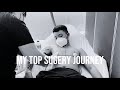 MY TOP SURGERY | JT LIM QUINTAL