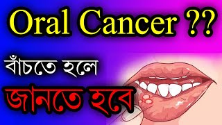 Oral Cancer in Bangla. মুখের ক্যান্সারঃ কারন, লক্ষন, প্রতিকার, প্রতিরোধ ও চিকিৎসা by smile bd