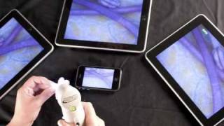 ProScope Mobile Launch