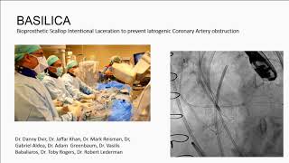 Terapia zastawka w zastawce: jaka zastawka dla jakiej protezy – Danny Dvir, MD