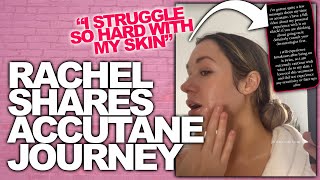 Bachelorette Rachel Recchia Opens Up About Skin Care Issues & How She Improved!