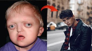 Parents abandoned their sick child, you won’t believe what happened to him!