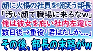 【感動する話】顔に火傷がある陰キャ社員を見下す上司「化粧くらいしろバケモノがw」彼女を庇った俺は窓際部署に社内左遷させられた。ある日→会社の重役が視察に来ると「君は確か…」俺「あ！」【泣ける話】