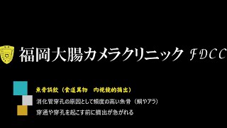 魚の骨を飲み込んだ場合の内視鏡治療。魚骨、鯛（食道異物　内視鏡的摘出）