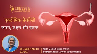 एक्टोपिक प्रेग्नेंसी के लक्षण, कारण और इलाज | Ectopic Pregnancy Symptoms, Treatments | Dr. Meenakshi