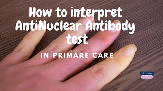 Approach to Demystifying the ANA and associated Serological Testing in primary care.