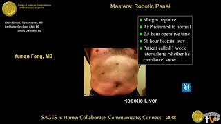 Robotic liver surgery