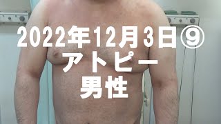 2022年12月3日⑨アトピー男性