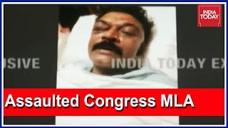 First Image Of Congress MLA Anand Singh In Hospital Here On India Today