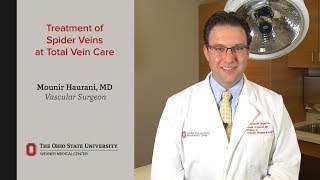 Spider vein treatment | Ohio State Medical Center