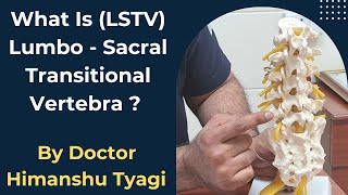 WHAT IS (LSTV)  LUMBO-SACRAL TRANSITIONAL VERTEBRA ?