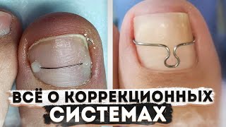 КОРРЕКЦИОННАЯ СИСТЕМА — ЧТО ЭТО?