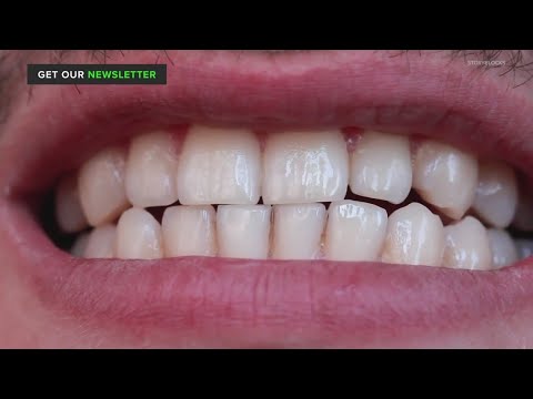 Do I need to brush my teeth after eating fruit?