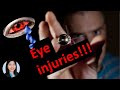 Eye injuries- don't get hurt by your loved ones