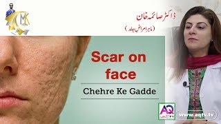 Scar on Face and very Easy Treat | Cehre ke Gadde | Dr Samia Khan | MK Show | AQ TV