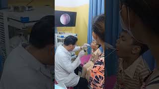 Real-Time Endoscopic Throat Exam – You Can See Everything! 📹👨‍⚕️ #InsideThroat #DoctorShorts