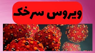 بیماری سرخک/علایم بیماری سرخک و راههای پیشگیری/هشدار شیوع سرخک/واکسن mmr