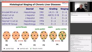 Hepatic fibrosis assessment using multiparametric biomarker tests