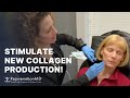 Sculptra Injections in the Face— Restore Volume & Improve Lift