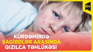 Kürdəmirdə 7 məktəbdə şagirdlər arasında qızılca yayılıb, 9 nəfər xəstəxanaya yerləşdirilib