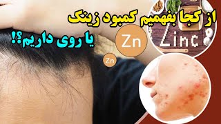 مهمترین علائم کمبود زینک یا روی چیست؟ #زینک #روی #منابع #کمبود #علائم