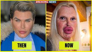 MOST SHOCKING Plastic Surgery Disasters in Hollywood REVEALED Now | Then and Now 2026