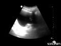 Ultrasound Video Challenge - Abdomen