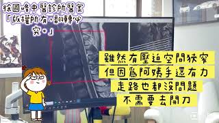 ＃神經根型頸椎病醫案＃主要手很酸但頸部無任何不適＃復健做牽引後血壓突然飆高＃歷經一個月的密集治療㊣頸椎整合中醫微創👉逆轉勝🫰感謝新北市林口區郭阿姨熱情見證