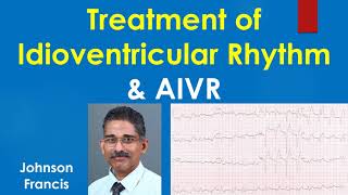 Treatment of Idioventricular Rhythm and AIVR