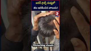 ఐరన్ గ్రిల్స్ మధ్యలో తల ఇరికించిన బాలుడు! | Child Head Stuck In Grills At Yadadri Temple | RTV