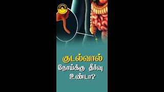 குடல்வால் நோய்க்கு தீர்வு உண்டா? #tamil #trending #trendingnow #shorts #appendicitis