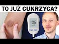 Poziom cukru na czczo i po jedzeniu: jaki jest prawidłowy? KRYTERIA, jak rozpoznać cukrzycę i objawy