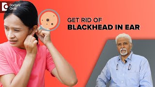 How to get rid of Blackheads in the Ear?| Ear Blackheads - Dr. Harihara Murthy | Doctors' Circle
