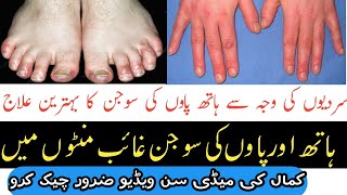 سردی کی وجہ سے ہاتھ اور پاؤں کی سوجن نے والی انگلیوں کا علاج|| hand \u0026 foot finger swelling treatment