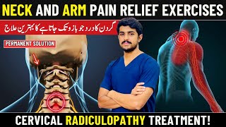 Cervical Radiculopathy: Neck And Arm Pain Relief Exercises At Home | Pinched Nerve