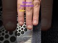 Bitten nails transformation before and after