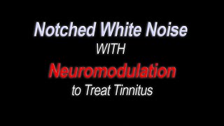 Combined Notched White Noise and Neuromodulation Tones to Treat Tinnitus