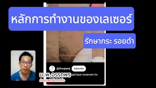 ทำไม เลเซอร์ทำให้รอยดำ กระแดด จางลงได้ | Dermatology